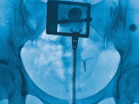 Lorde, "Man of the Year" do álbum "Virgin"